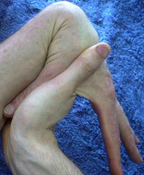 Forward fold : thumb side of wrist